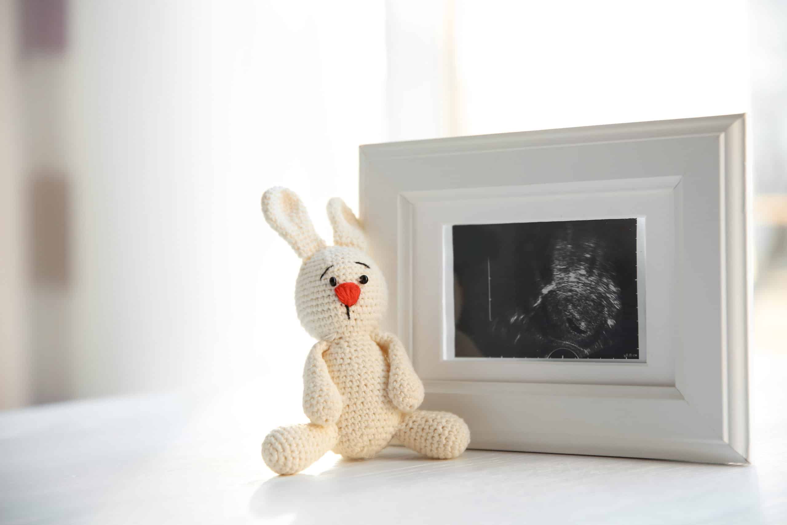 Ultrasound photo and bunny bear